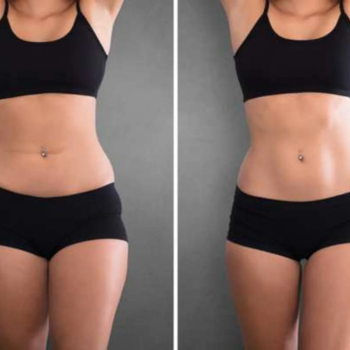 Muscle Toning Treatment at Skin N U Clinics, Kokapet
