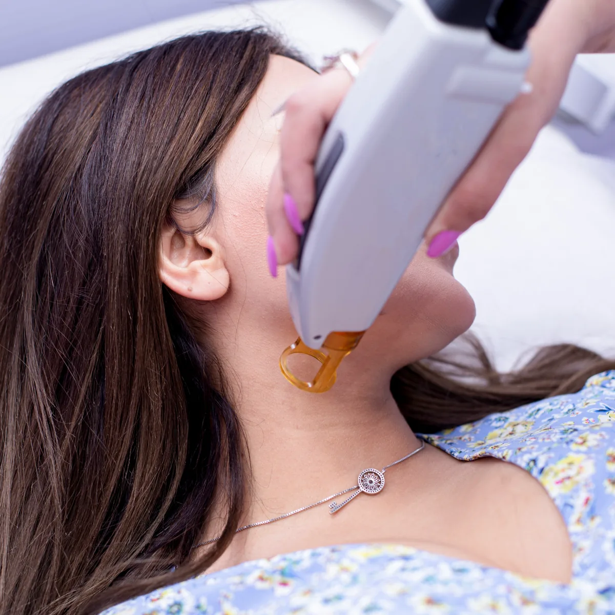 Laser Toning (Q-Switched Laser) at Skin N U Clinics, Kokapet