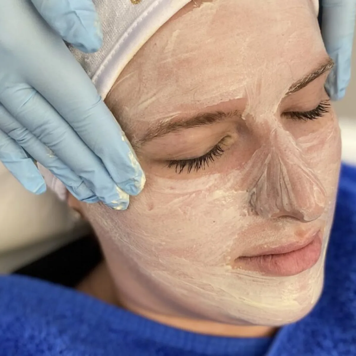 Face & Skin Rejuvenation (Aesthetics) at Skin N U Clinics, Kokapet