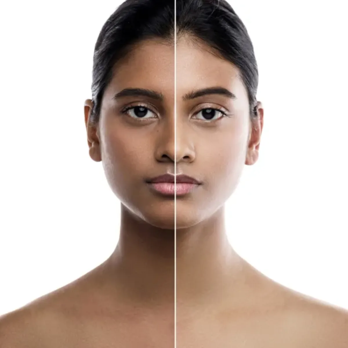 Skin Lightening & De-tan Therapies at Skin N U Clinics, Kokapet