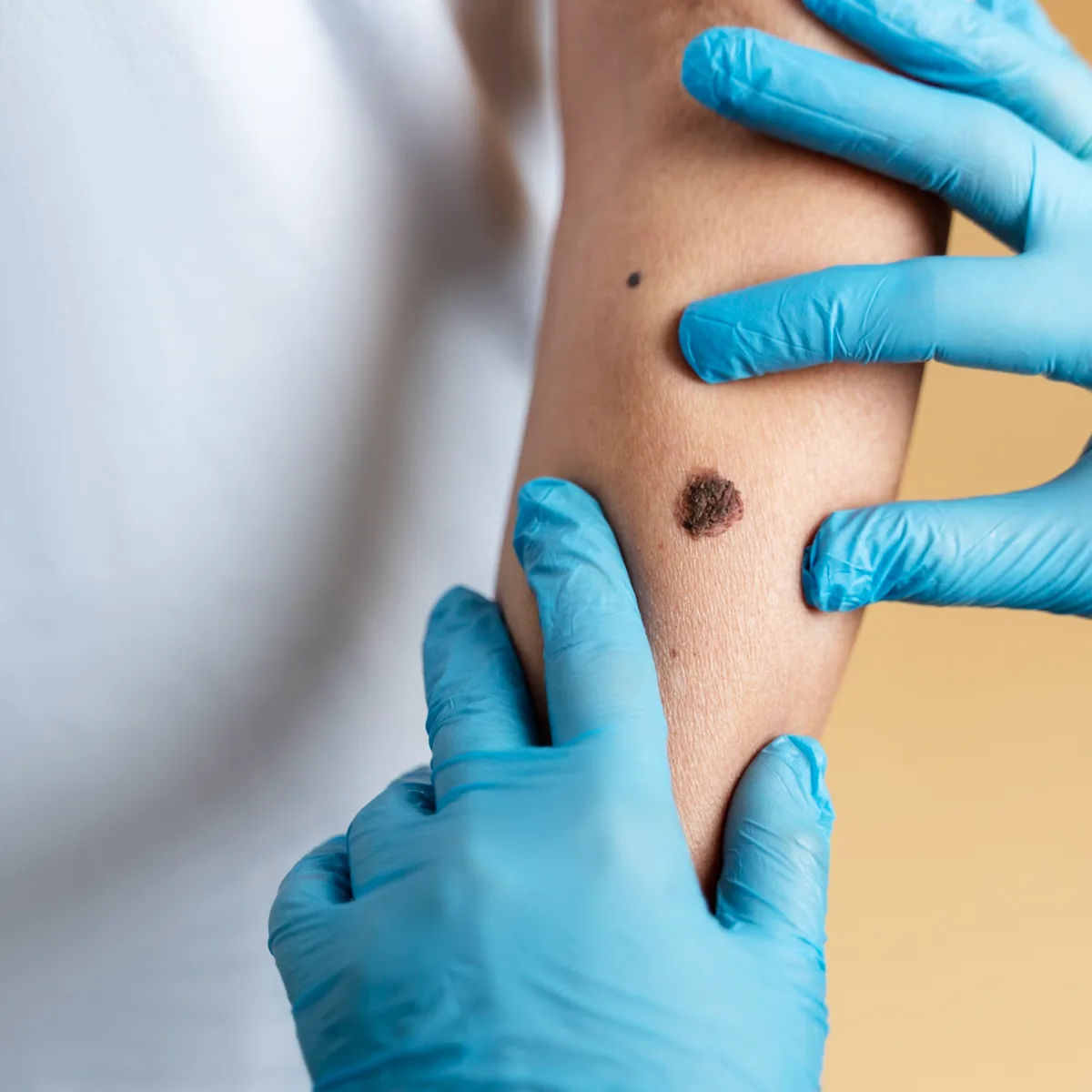 Clinical Dermatology & Dermatosurgery at Skin N U Clinics, Kokapet